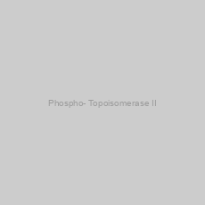 Image of Phospho- Topoisomerase II